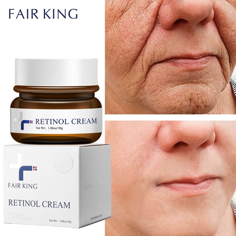 Retinol Anti-Aging Face Cream: Reduces Wrinkles and Smoothes Rough Skin, Increase Skin Elasticity 30g - adamshealthstore