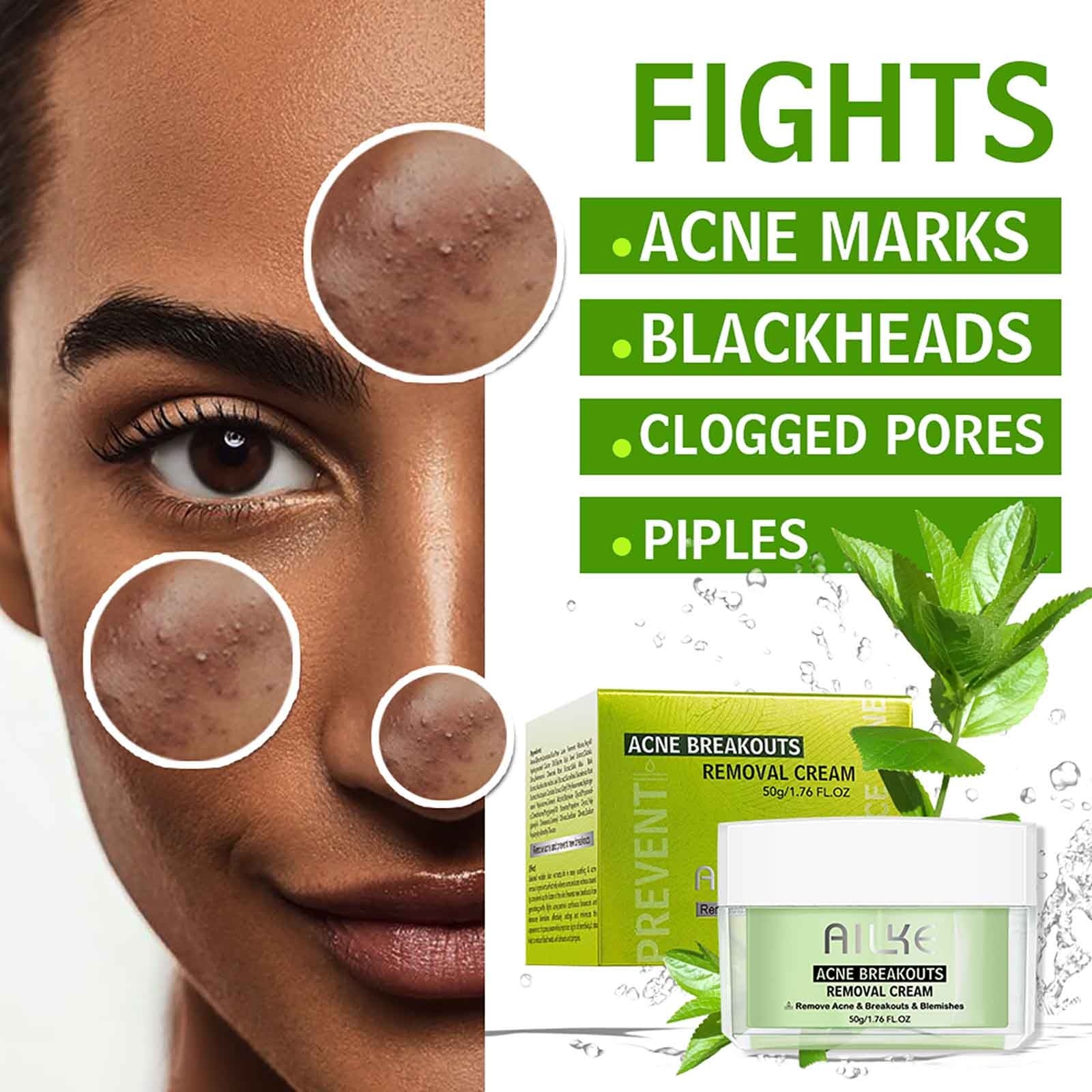 AILKE Organic Anti Acne Skin Care, Effectively Beat Acne-prone Skin, Repairing Acne Spot Treatment , Prevent Face Breakout - adamshealthstore