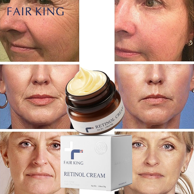 Retinol Anti-Aging Face Cream: Reduces Wrinkles and Smoothes Rough Skin, Increase Skin Elasticity 30g - adamshealthstore